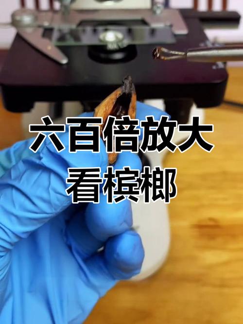 嚼槟榔20年患口腔癌,嚼槟榔20年患口腔癌几率大吗